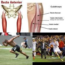 Lesion Recto Anterior